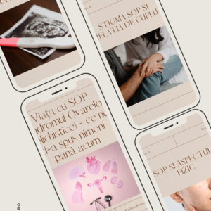 Viața cu SOP - Ce nu ți-a spus nimeni până acum